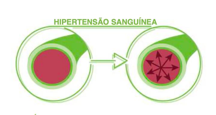 Suplemento Natural - Pressão Arterial | IPERTENVIN 50ML ***
