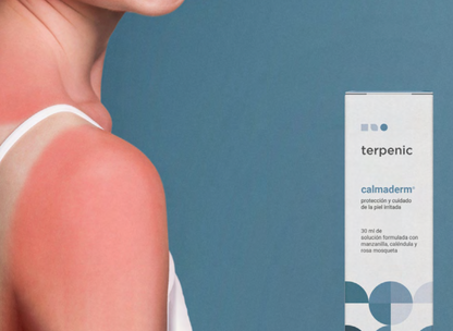 Solução Natural | Óleo peles irritadas (calmaderm) 30ml.